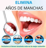 Blanqueamiento Dental - Cocoderm